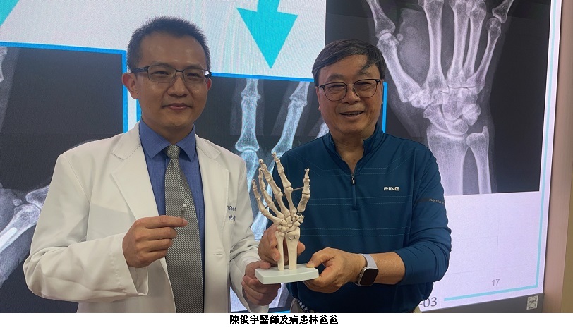 精準重建拇指功能 新式人工關節治療拇指基底關節退化性關節炎成果發表