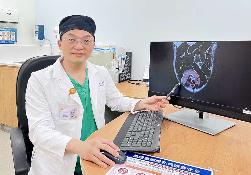 高市6旬男腹痛高醫岡山醫院急診 剖腹探查術迴腸夾出完整香菇