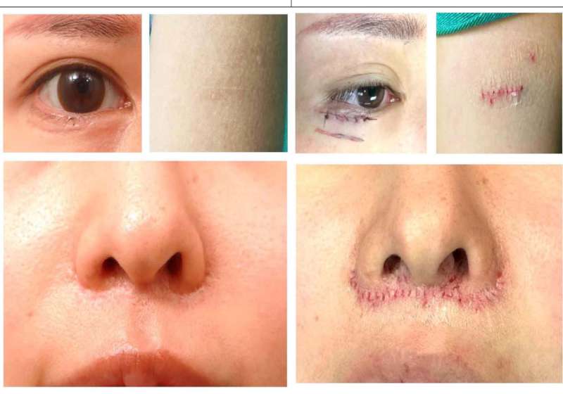 日本東京、京都男女滿意成效 國際白疤中心創辦人曹賜斌自豪呼應首相挺台言論